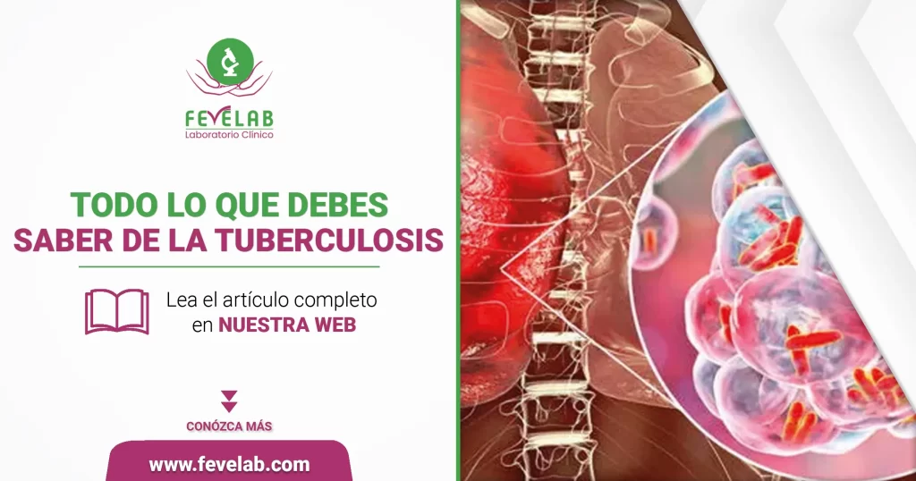Tuberculosis